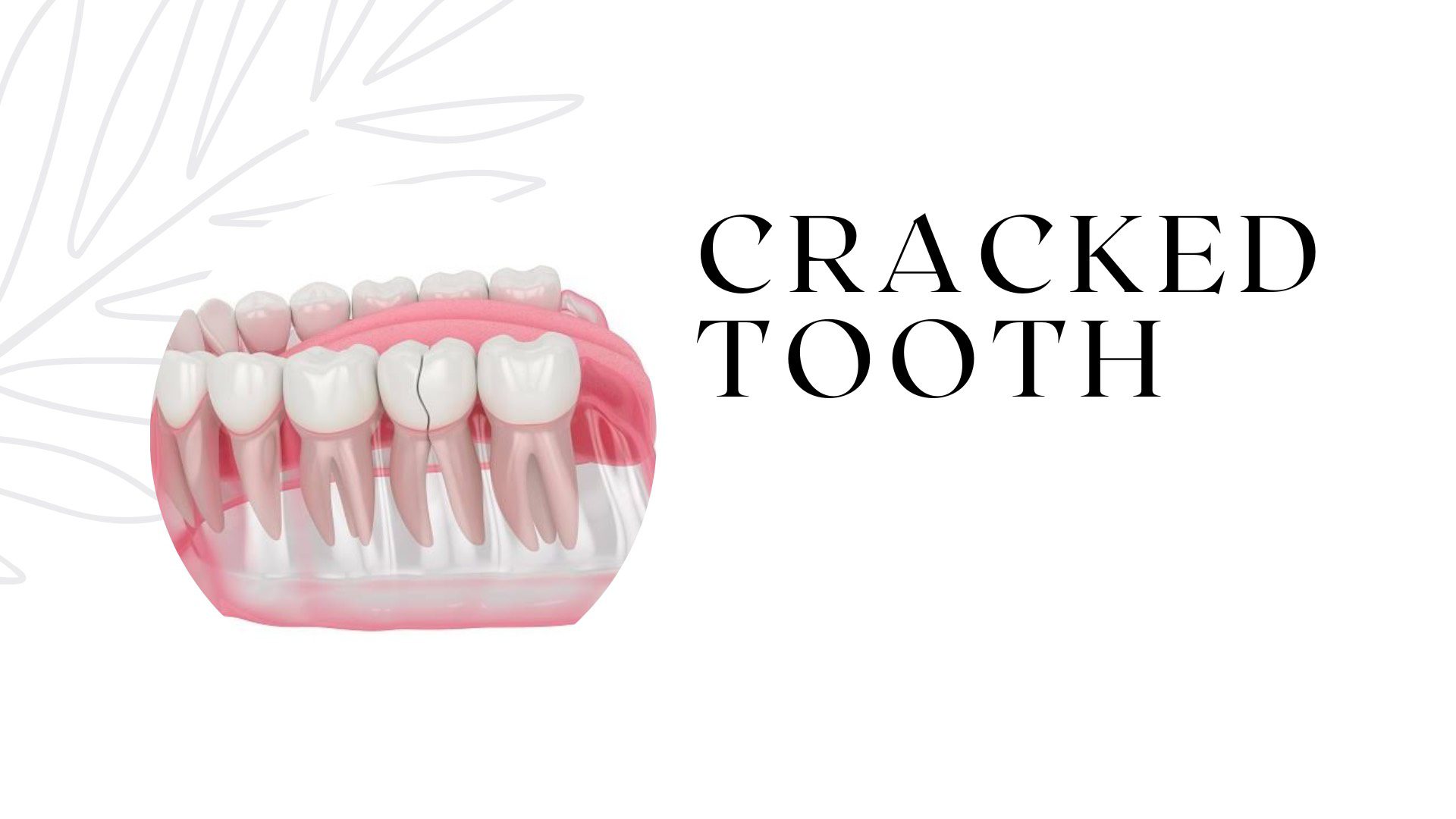 Oral surgery procedure